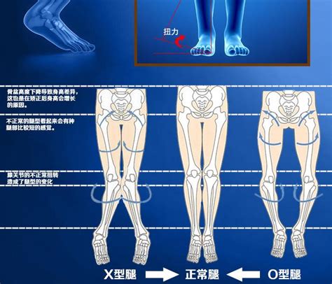 外八字走路|走路“外八”只是脚的问题？10个动作帮你矫正！超简单~